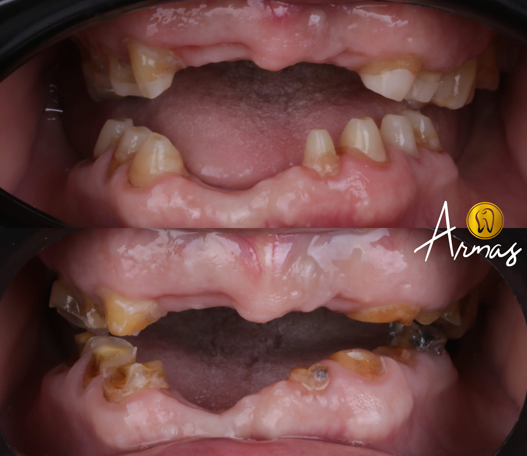 Dentista-Reynosa-DrSergioArmas-nov01