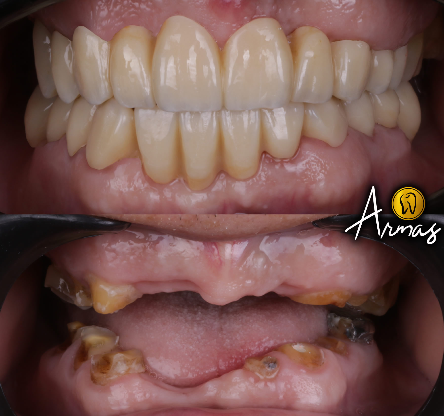 Dentista-Reynosa-DrSergioArmas-nov02
